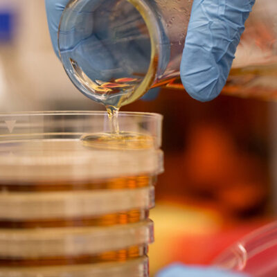 Gift accelerates new treatment possibilities for neuroendocrine tumors.